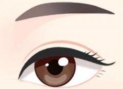 双眼皮增生科普：增生原因、易发期及解决办法