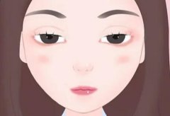 北京双眼皮手术价格怎么样？常见方法/恢复时间