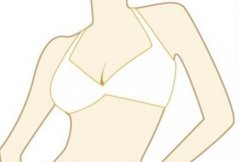 上海九院谢芸医生脂肪填充案例上线，技术过关服务到位！