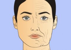 大拉皮手术能维持多久大概多少钱？护理事项/恢复时长分享
