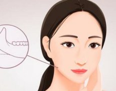 整形下巴需要多少费用？整形下巴注意事项一览
