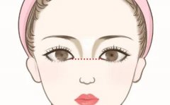 隆鼻后黑头怎么处理？可以选择热敷/涂抹药物/果酸护肤等方式